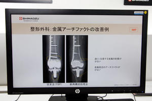 開発中のトモシンセシス新画像再構成処理法