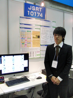 JSRT 10174