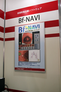 仮想気管支鏡画像を作成し気管支鏡検査をサポートする「Bf-NAVI」