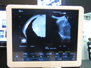 安全な穿刺を支援する「Real-time Virtual Sonography（RVS）」
