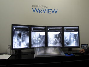画像システム「WeVIEW」の4面構成