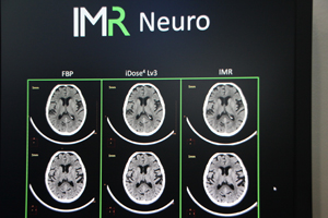 「IMR」では，大幅にノイズを低減させることが可能
