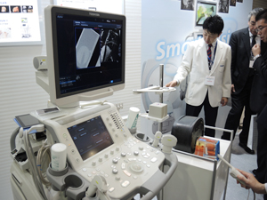 「Aplio 500」の“Smart Fusion”機能が経直腸プローブにも対応
