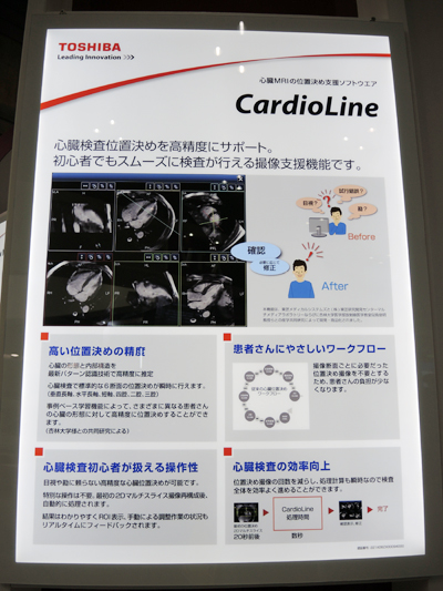 「Vantage Titan 3T」に搭載可能になった「CardioLine」