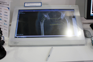 「OrthoPlanner Pro」をワコムのペンタブレットで使うこともできる。