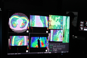 PhyZiodynamic技術を利用した「4Dモーション解析」