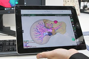 iPadなどモバイル端末でSYNAPSE VINCENTの解析画像を参照できることをアピール