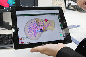 iPadなどモバイル端末での解析結果参照機能を新たに搭載