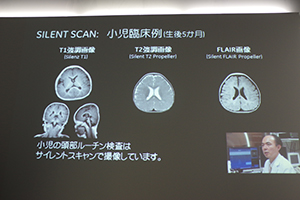 SILENT SCANの小児検査での有用性を紹介