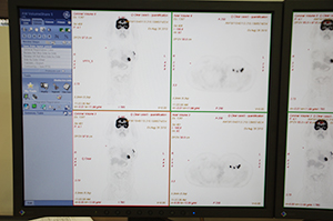 高い定量性を実現するQ.Clearの画像（下段）
