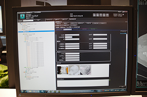 治療用RISのiRad-RTはiRad-RSとの連携で診断から治療までの情報を一元的に管理