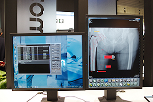 豊富なインプラントをテンプレートに収めたiRad-OT