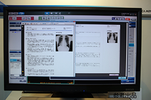 クリニックなどで胸部X線画像の診断をサポートする診断支援navi