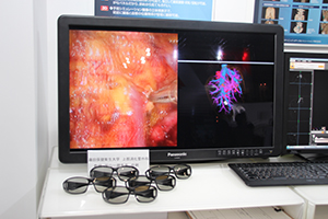専用の3D眼鏡により立体視できる3Dモニタは手術支援や医学教育に有用