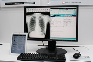 iPadを用いて訪問先でのカルテの参照・入力も可能な「SimCLINIC T3α」