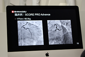 新しい画像処理システム“SCORE PRO Advance”