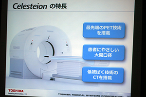 大口径ガントリなどの特長を持つCelesteion