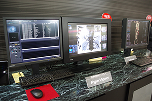 Aquilion ONE/ViSION Editionのオプションとして提供する裸眼3Dディスプレイ「HyperViewer」