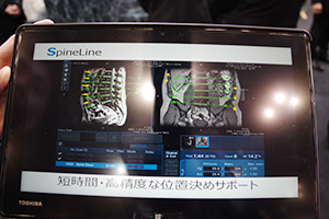 Vantage Elanに搭載されるアプリケーションのSpineLine