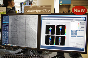 DTSのウインドウを表示したCardioAgent Pro