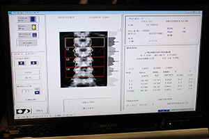 QDR Horizonの解析画面