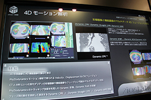 PhyZio Maker Serverの機能の1つである4Dモーション解析。Dynamic CPRやDynamic ROIなどの計測機能で診断を支援