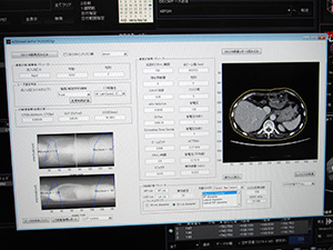 SSDEでの線量管理が可能な「線量管理支援ツール」（W.I.P.）