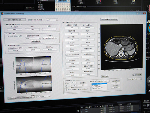 線量管理支援ツール（W.I.P.）の画面。線量指標として，CTDIvol，DLP，SSDEが自動で算出される。