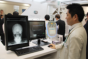 BENEO- Fxでは一体型コンソールで撮影から画像処理まで対応