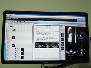 診療情報を統合管理する「Centricity Clinical Archive」