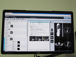 少ないクリック数で操作できるCentricity Clinical Archive