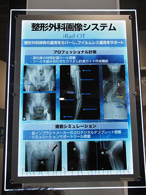 デジタルテンプレートを豊富に搭載した「iRad-OT」