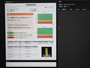 骨密度測定の結果はレポート形式でも表示可能
