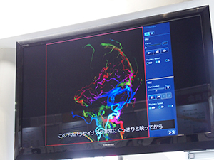 造影剤到達時間をカラーの動画像で表示するCCC