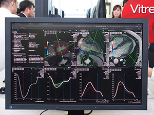 Vitrea V7に搭載予定のMRIの心機能解析機能