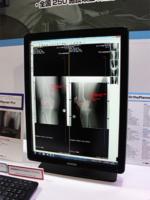 OrthoPlanner Pro