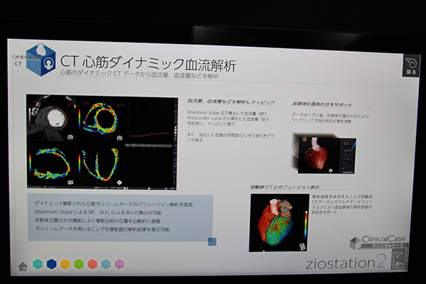 ダイナミックCTデータからパーフュージョン解析を行う「CT心筋ダイナミック血流解析」
