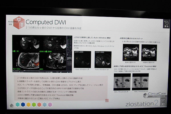 2つのDWIから任意のb値を作成する「Computed DWI」