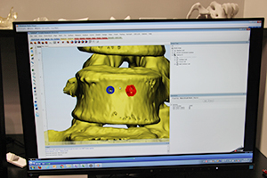 高度な画像編集が可能なSTL編集ソフトウエア「Materialise 3-matic」