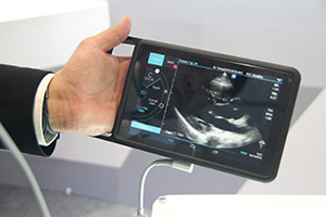 SonoSite iVizのBモード画像