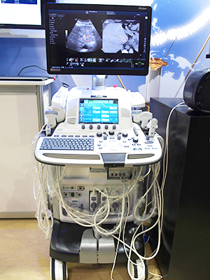Liverコーナーの「LOGIQ E9 with XDclear2.0」