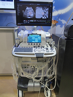 Volume Navigation搭載のLOGIQ E9 XDclear 2.0