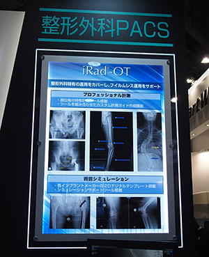 整形外科用PACSのiRad-OTの説明パネル