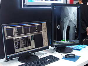 インプラントのテンプレートが豊富なiRad-OT