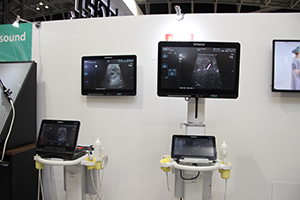 手術室で使いやすい「ARIETTA Precision」