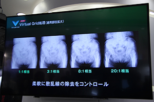 適用部位が拡大した「Virtual Grid」
