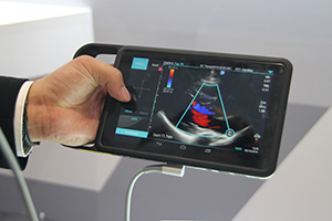 片手で操作可能なタブレット型超音波画像診断装置「SonoSite iViz」