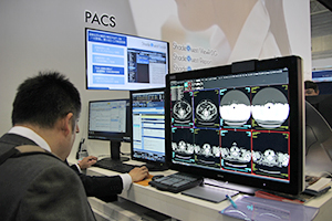 連携を含めて機能が強化されたPACSソリューション