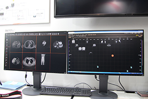 Medical Image PlaceにアトラスコープMCビューアが搭載可能になった。