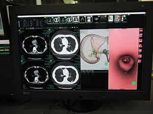 SYNAPSE 5ではSYNAPSE VINCENTとの連携を強化
